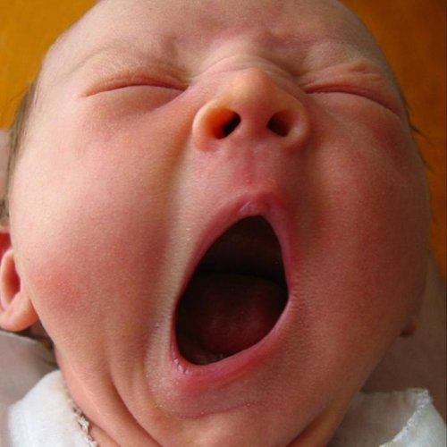  پادکست✳️ چرا خمیازه مسری است؟ ✳️