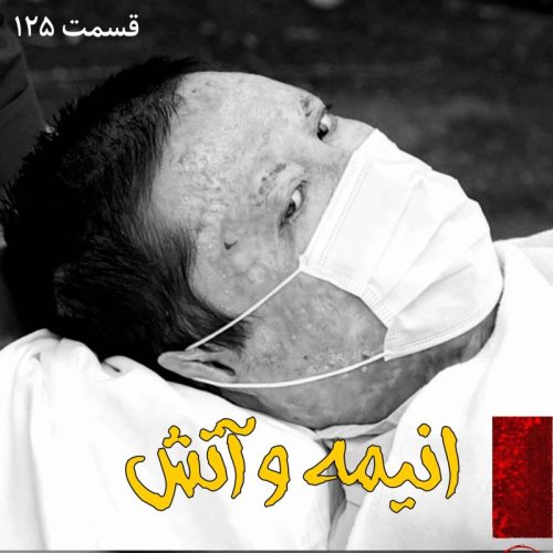  پادکستانیمه و آتش