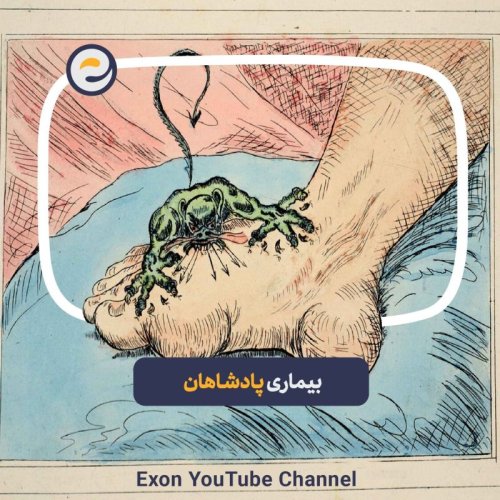  پادکستاپیـزود ویژه _ مرضی که گریبان شاهزاده ها را میگرفت